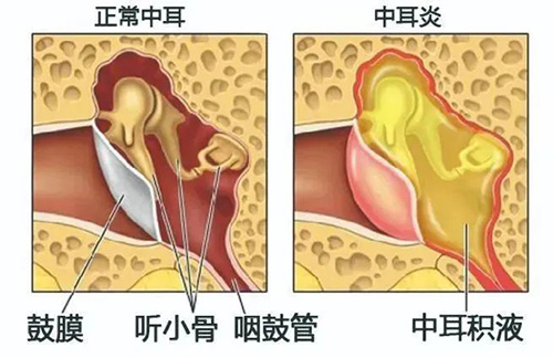 一年一度爱耳日，今年关爱不一般