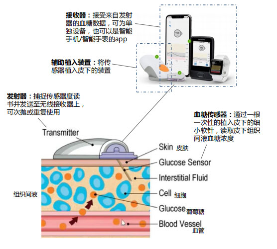 @糖友：不用扎针就能24小时轻松测血糖！血糖监测就是这么简单！