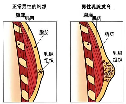 从“硬汉”到“奶爸”——乳腺健康不分性别，守护从了解开始