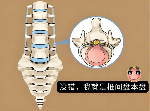 【惠民科普】腰间盘的“变形记”——告别“突出”，迎接健康